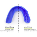 Tooth protector Sisu 3D Snow White